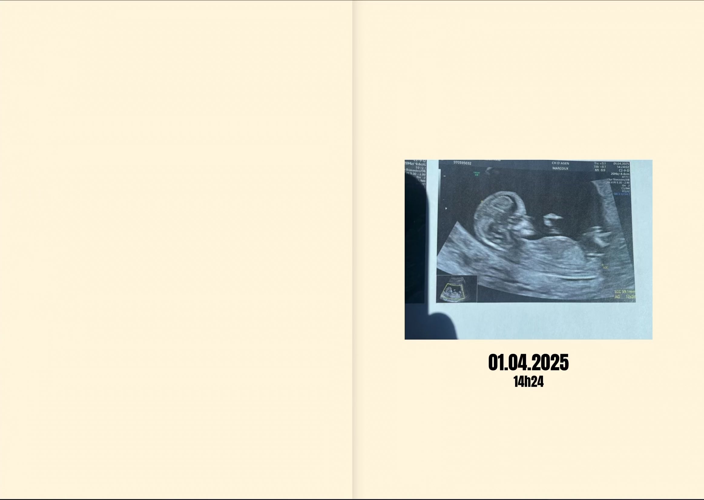 Template baby + de 30 pages